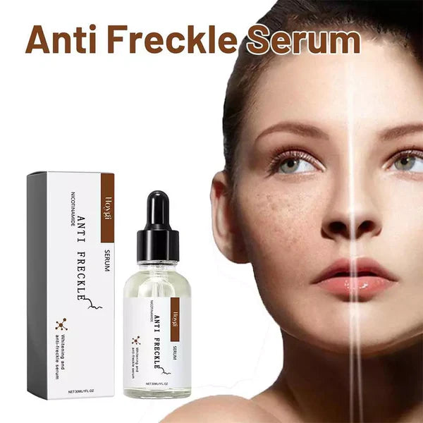 Anti-Freckle Serum – Dark Spot Remover & Skin Brightening | Hala Grace