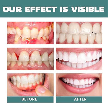 Eelhoe Mouth Relief Spray – Soothing Oral Care Solution | Hala Grace