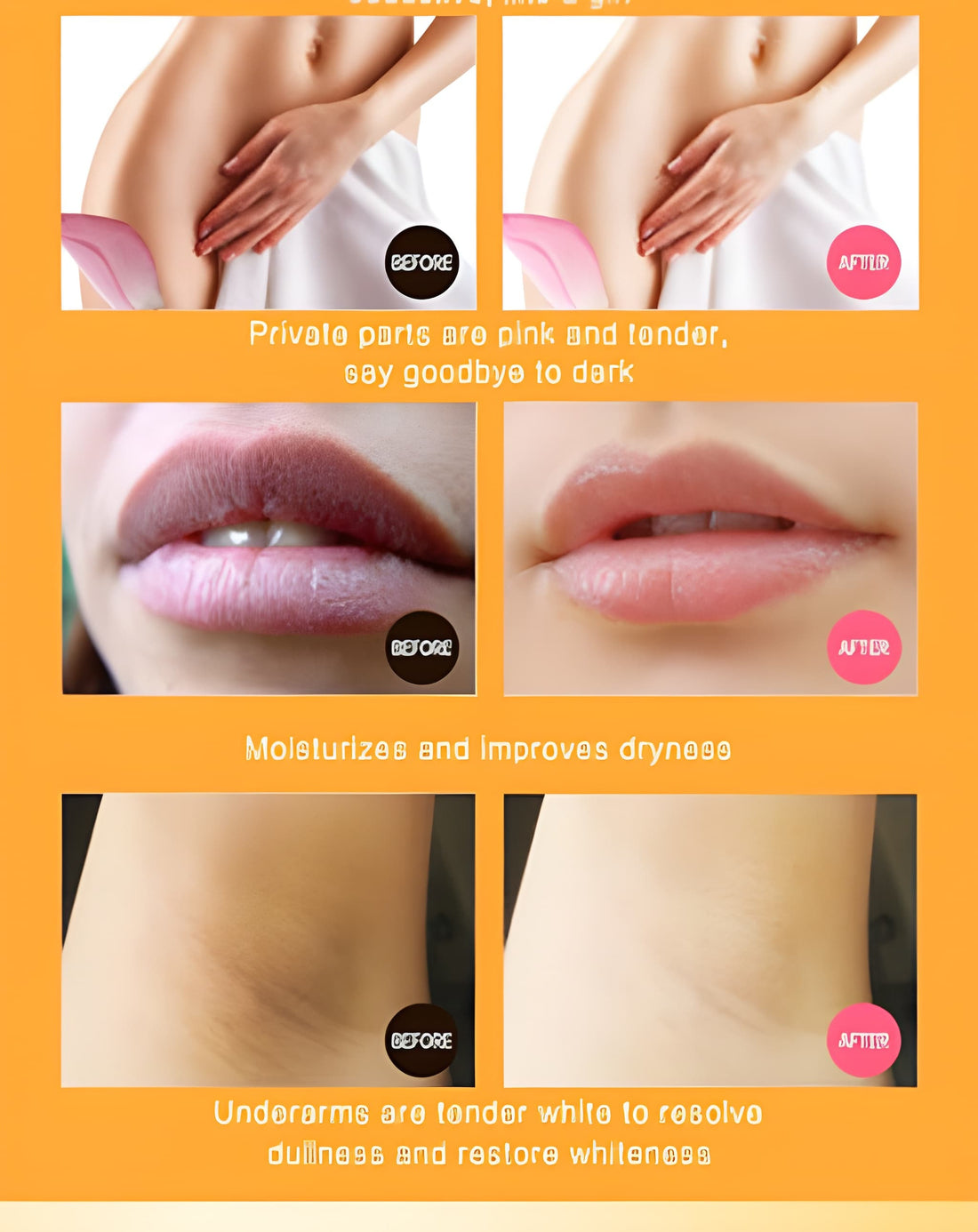 Dr Rashel - Vitamin C Privates Parts Whitening Cream