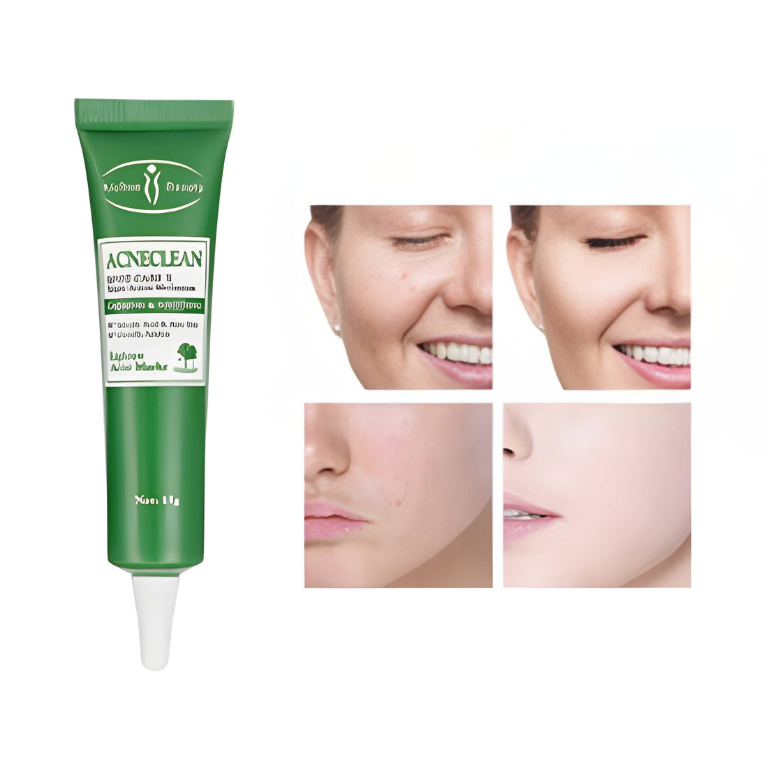 Aichun Beauty - Acne Clean Spot Care X